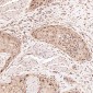 Anti-Ki67 MKI67 Rabbit Monoclonal Antibody